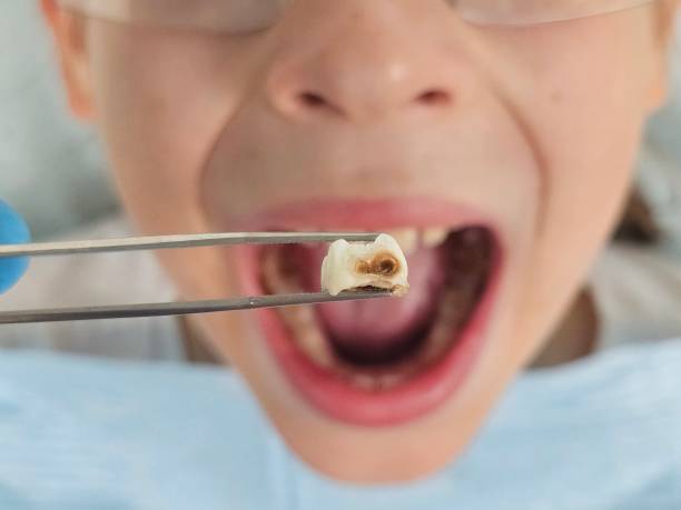 Best Emergency Gum Pain Relief  in Sconsin Dells, WI